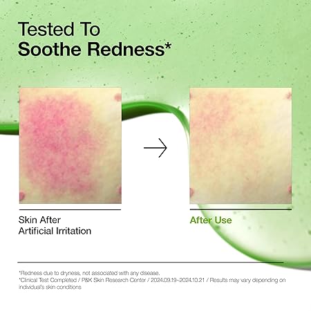 Anua Azelaic Acid 10 Hyaluron Redness Soothing Serum, Facial Serum for Sensitive skin, Hyaluronic Acid, Niacinamide, Spot Care, Natural Color, Vegan, Korean Skincare (30ml/ 1.01 fl oz)