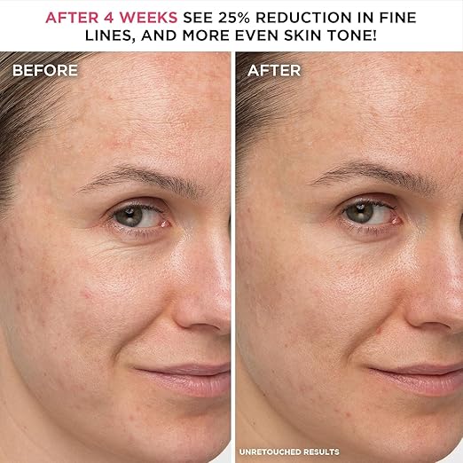 IT Cosmetics Confidence in a Cream - Hydrating & Anti Aging Face Moisturizer, Visibly Reduces Fine Lines, Wrinkles & Signs of Aging, Repairs Skin Barrier, With Squalane & Ceramides, For All Skin Types 4 US fl oz/ 120ml