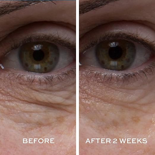 ELEMIS Peptide4 Eye Recovery Cream, Reviving Eye Cream, 0.5 Fl Oz/ 15ml