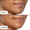 Sunday Riley U.F.O. Ultra-Clarifying Salicylic Acid and Tea Tree Acne Treatment Face Oil 15ml/ 0.5 fl oz