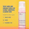 Good Molecules Acne Foaming Cleanser - 2% Salicylic Acid Foam Cleanser - Gentle Acne Face Wash with Alcohol Free Witch Hazel and Aloe - Skin Care for Face 148ML