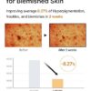 celimax Ji.Woo.Gae Pore+Dark Spot Brightening Pad | Exfoliating Peeling Pads for Enlarged Pores, with Hyaluronic Acid, Pore Minimizer, Non-Irritating, Hydrating, For Sensitive Skin (40 pads)
