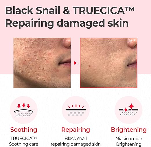 V333 SOME BY MI Snail Truecica Miracle Repair Toner - 4.6Oz, 135ml - Made from Snail Mucin for Sensitive Skin - Daily Repair Face Toner with Skin Texture and Pigmentation Care - Korean Skin Care