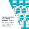 CeraVe Resurfacing Retinol Serum For Post Acne Marks, Formulated With Licorice Root Extract & Niacinamide, Brightening Serum & Pore Minimizer For Face, Post Acne Skin Barrier Repair, Non-Comedogenic 30ML /1FL OZ