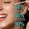 Balance Active Formula Niacinamide Blemish Recovery Serum - 15% Niacinamide for Clear Skin, Blemish Reduction, Lightweight & Non-Sticky, Refines Texture - 30ml