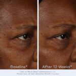 Obagi Elastiderm Facial Serum – Firming Face Serum With Patented Bi-Mineral Contour Complex Clinically Proven To Target Signs Of Skin Aging 1 Fl Oz/ 30Ml