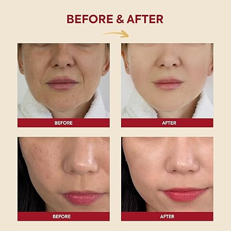 K-SECRET SEOUL 1988 Essence : Snail Mucin 97% + Rice | 97% Snail Secretion with Rice Ferment Filtrate and Rice Extract for Skin Hydration, Soothing | Korean Skincare | 100ml/ 3.38 fl oz