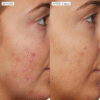 Sunday Riley B3 Nice 10% Niacinamide Serum 1.0 fl oz/ 30ml