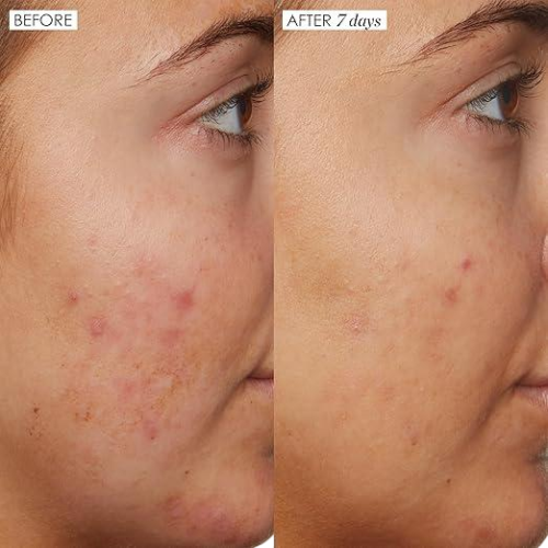 Sunday Riley B3 Nice 10% Niacinamide Serum 1.0 fl oz/ 30ml