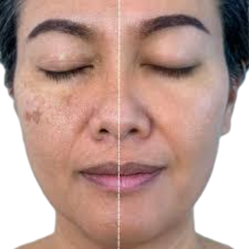Pigmentbio Foaming Cream Hyperpigmented skin, dark spots  Exfoliating cleanser for brightened skin right from the shower.