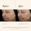 SkinMedica TNS Advanced+ Serum - Our Premium Facial Skin Care Product, the Secret to Flawless Skin. Age-Defying Face Serum for Women is Proven to Address Wrinkles and Fine Lines for Glowing Skin,1 Oz/ 28.4g