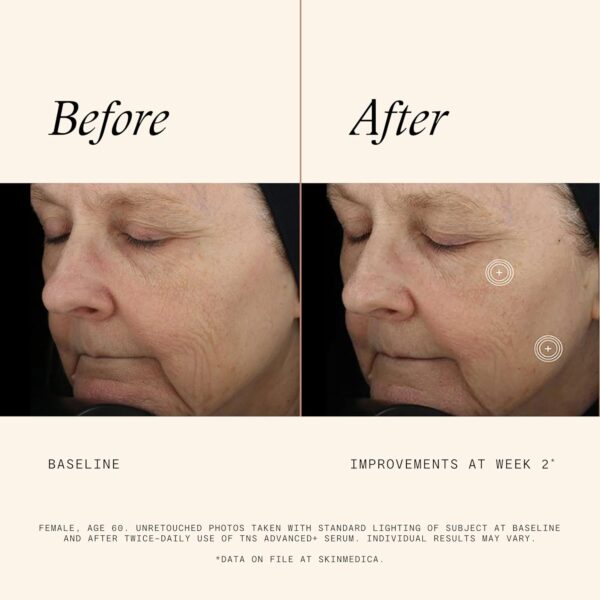 SkinMedica TNS Advanced+ Serum - Our Premium Facial Skin Care Product, the Secret to Flawless Skin. Age-Defying Face Serum for Women is Proven to Address Wrinkles and Fine Lines for Glowing Skin,1 Oz/ 28.4g