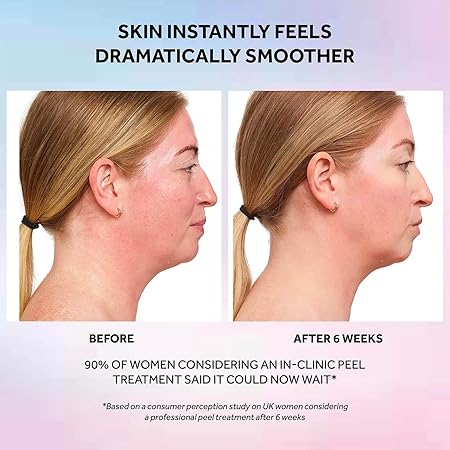 ujj No7 Laboratories Resurfacing Peel 15% Glycolic Acid - Skin Resurfacing Face Peel for Smoother Skin - Brightening Pore Cleanser + Face Peeling Treatment for Impurities & Dead Skin Cells 30ml/ 1.0 fl oz
