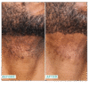 Daily Mens Exfoliating Face Wash + Scrub | Urban Skin Rx® | Powerful 2-in-1 Cleanser and Scrub | Cleans Pores of Dirt and Oil. Formulated with Salicylic Acid, Jojoba Beads and Niacinamide | 5.1 fl oz/ 150ml