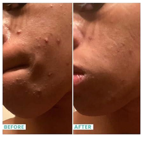 Urban Skin Rx Clear Skin Cleansing Bar | 3-in-1 Daily Cleanser, Exfoliator and Mask Removes Excess Oil and Improves Blemishes, Formulated with Salicylic Acid, Eucalyptus and Sulfur | 3.7 Oz/ 100g