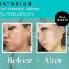 Naturium Niacinamide Face Serum 12% Plus Zinc 2%, Anti-Aging, Pore Minimizer & Dark Spot Corrector with Hyaluronic Acid & Vitamin E, Vegan & Cruelty-Free, 1.0 fl oz/ 30ml