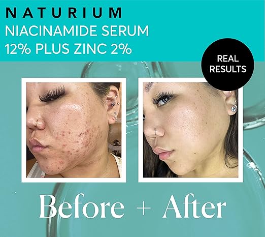Naturium Niacinamide Face Serum 12% Plus Zinc 2%, Anti-Aging, Pore Minimizer & Dark Spot Corrector with Hyaluronic Acid & Vitamin E, Vegan & Cruelty-Free, 1.0 fl oz/ 30ml