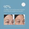Naturium Retinol Complex Serum, Encapsulated Retinols & Bakuchiol, Refining & Smoothing Facial Serum, 1 fl oz/ 30ml