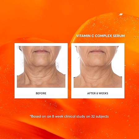 Naturium Vitamin C Complex Face Serum, Anti-Aging Facial Treatment with Hyaluronic Acid & Vitamin E, 1 fl oz/ 30ml
