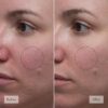 philosophy microdelivery resurfacing solution - with 4% ahas, cica & vitamin C - reduces the appearances of fine lines & pores - 5 fl oz / 150 ml