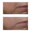 Perricone MD Cold Plasma Plus+ Advanced Serum Concentrate | Lightweight Serum | Targets fine lines, wrinkles, enlarged pores, dullness, uneven texture & tone, discoloration, redness & loss of firmness 59ml / 2 fl oz