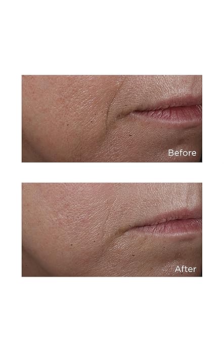 Perricone MD Cold Plasma Plus+ Advanced Serum Concentrate | Lightweight Serum | Targets fine lines, wrinkles, enlarged pores, dullness, uneven texture & tone, discoloration, redness & loss of firmness 59ml / 2 fl oz