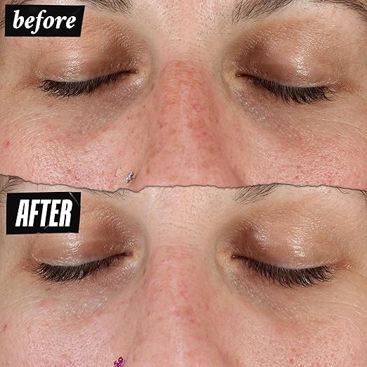 Kiehl's Clearly Corrective Dark Spot Serum, Brightening Facial Serum, Reduces Hyperpigmentation & Post-acne Marks, with Vitamin C & Salicylic Acid, All Skin Types, Paraben-free, Mineral Oil-free 1.7 fl oz/ 50ml